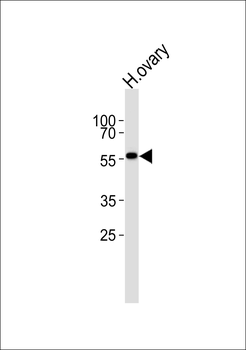 MPP7 Antibody (N-term)