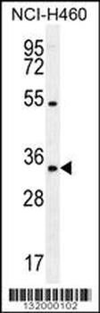 PURB Antibody (C-term)