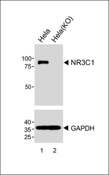 NR3C1 Antibody