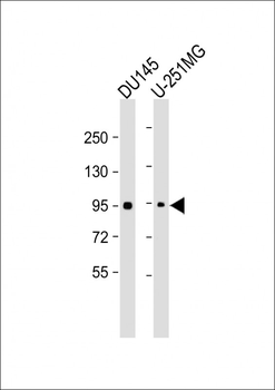NR3C1 Antibody