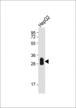 SULT1A1 Antibody