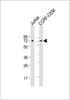 CBFA2T3 Antibody
