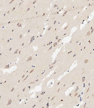 MAP1LC3A antibody(N-term)