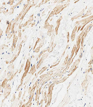 MAP1LC3A antibody(N-term)