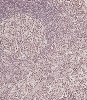 CDC25A (S124) Antibody
