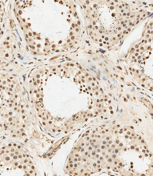 METTL14 Antibody (N-Term)