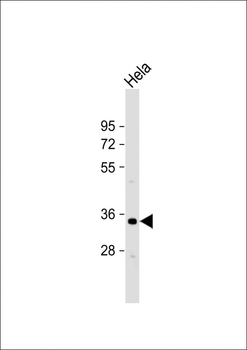 OR1B1 Antibody (Center)