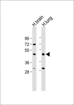 IFT57 Antibody (Center)