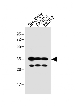 OR5V1 Antibody (C-term)