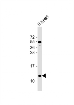 NDUFA2 Antibody (C-Term)