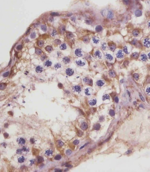 TGFBR3 Antibody (N-Term)