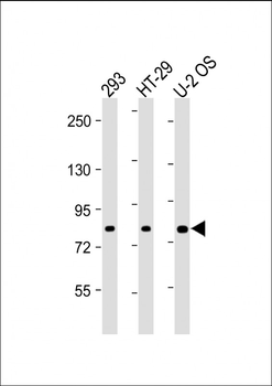 ADD1 Antibody (Center)