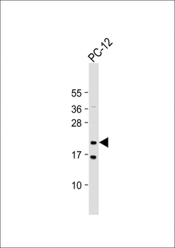 NRAS Antibody