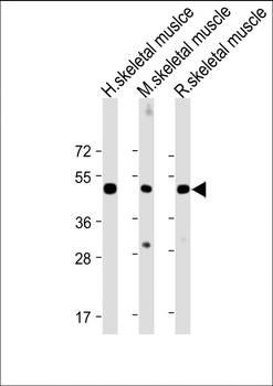 CHRNE Antibody (Center)
