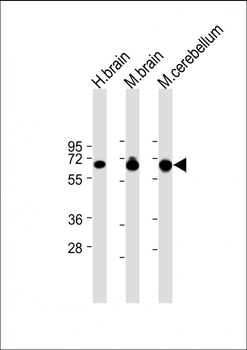 SLC1A3 Antibody (N-Term)