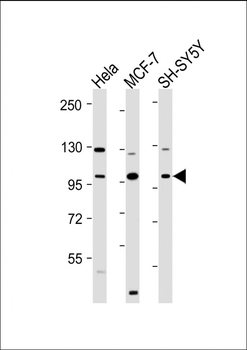 VAV2 Antibody (N-Term)