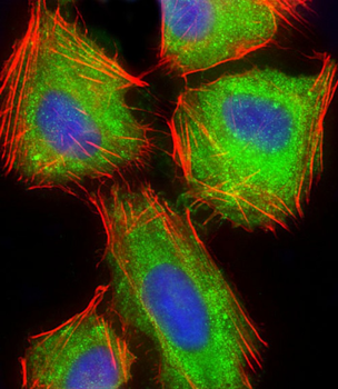 ARPC5 Antibody (Center)