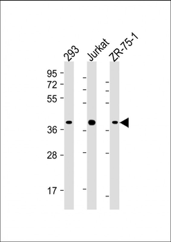 HIF1AN Antibody (C-term)