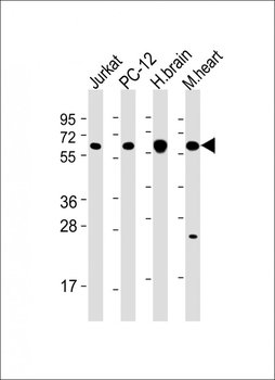 CAMK2 beta Antibody (C-term)
