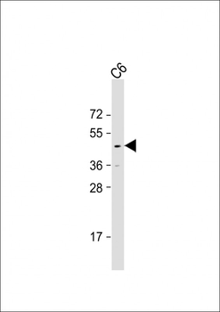 GSK-3B (Thr390) Antibody
