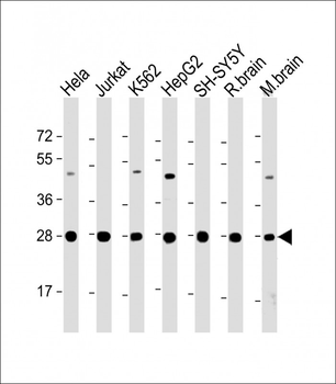 HSD17B10 Antibody (Center)