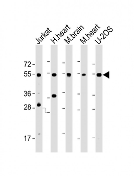 IRX4 Antibody (C-Term)