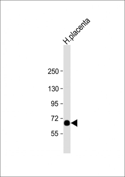 STT3A Antibody (Center)
