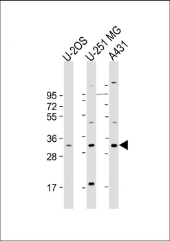 FAM125A Antibody (Center)