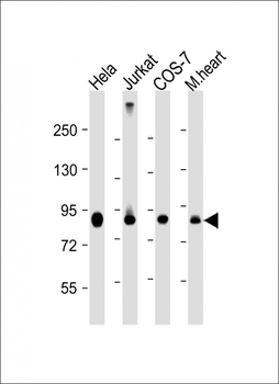 PFKP Antibody (C-term)