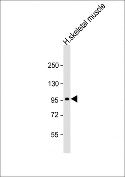 SULF1 Antibody (C-Term)