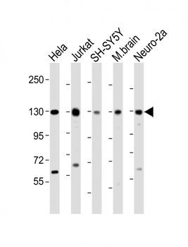 DBN1 Antibody (Center)