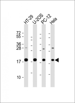 STMN1 Antibody (C-Term)