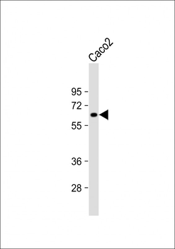 ME1 Antibody (N-Term)