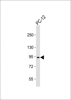 PCSK1 Antibody (N-Term)