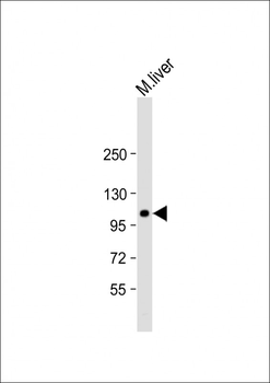 GART Antibody (C-Term)