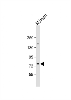 SLC6A8 Antibody (N-Term)