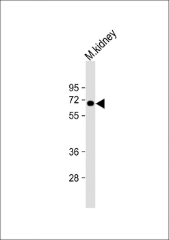 MGAT4A Antibody (N-Term)