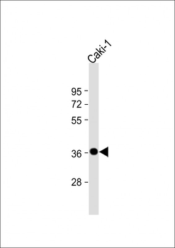 ANKRD1 Antibody (N-Term)