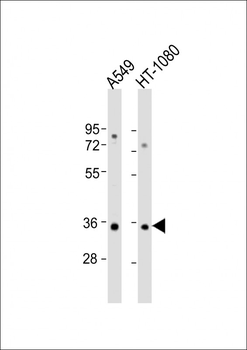 RSPO3 Antibody (C-Term)
