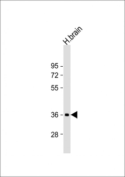 NMNAT1 Antibody (C-Term)