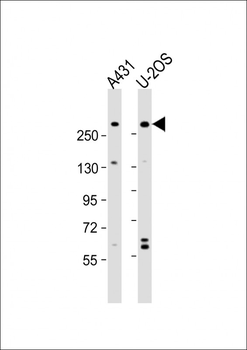 NBAS Antibody (N-Term)