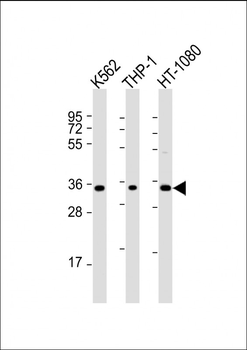 TMEM158 Antibody (C-Term)