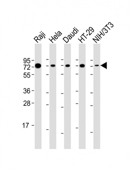 KHDRBS1 Antibody (Center)