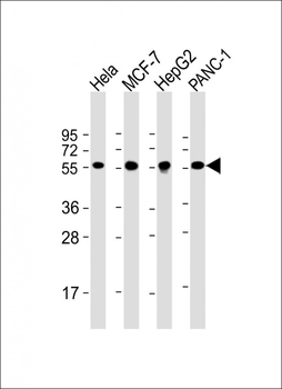 PDIA1 Antibody [Knockout Validated]