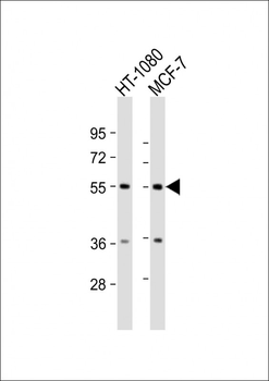 TMEM184C Antibody (C-Term)
