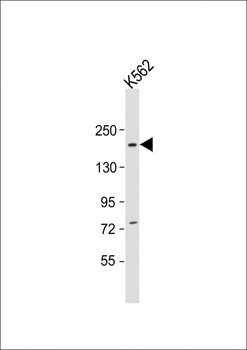 NCOA2 Antibody (Center)