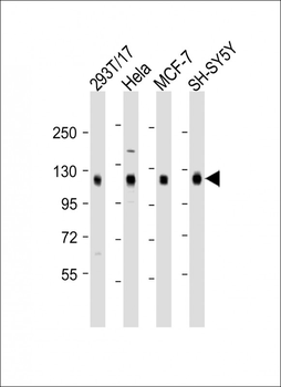DLG1 Antibody (Center)
