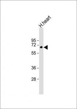 DVL1L1 Antibody (N-Term)