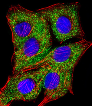 TIMP2 Antibody