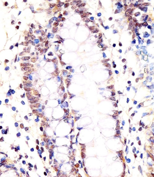 LSM2 Antibody (C-Term)